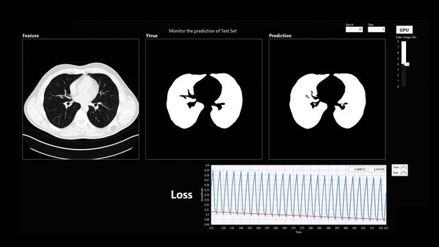 HAIBAL LabVIEW deep learning toolkit U-Net: Convolutional Networks for Biomedical Image Segmentatio смотреть онлайн