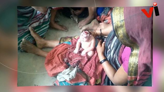 Baby Born With Extremely Rare Deformity Is Rejected By His Mum 'For Looking Like An Alien' смотреть онлайн