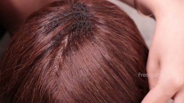 Remove Ticks Headache poor # 1025