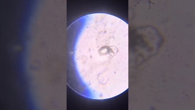Microscopy: Return to Electrolysis 24 Hours Later, Metal Container Fresh Pee, Bio Scums смотреть онлайн