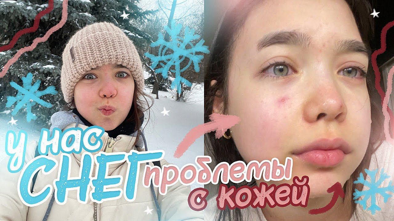 VLOG Зимний ВАЙБ ✨ Мои проблемы с кожей... смотреть онлайн