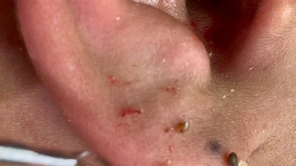 Satisfying video with Chung Vo Spa #115