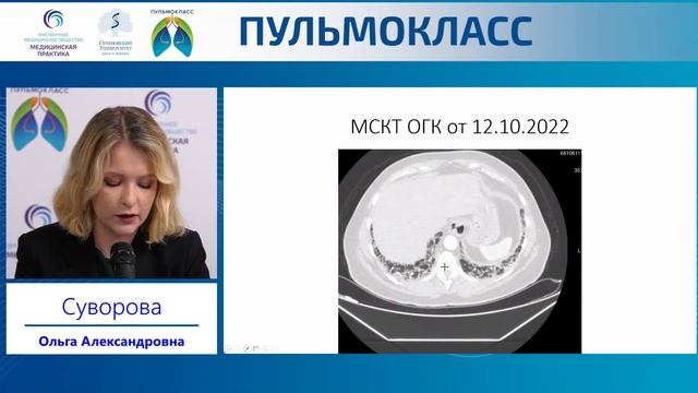 ПУЛЬМОКЛАСС смотреть онлайн