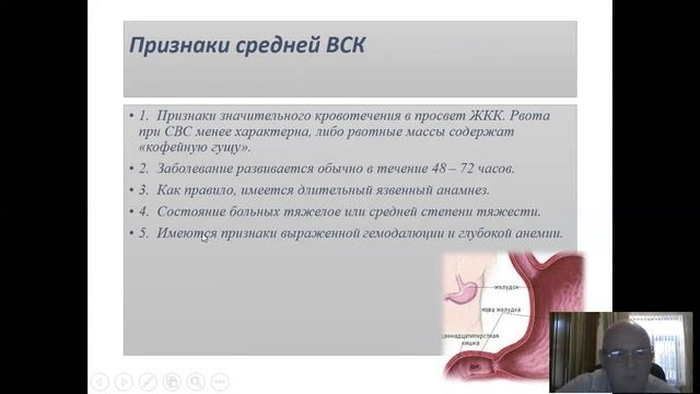 КРОВОТЕЧЕНИЯ ИЗ ПИЩЕВАРИТЕЛЬНОГО ТРАКТА смотреть онлайн