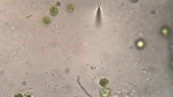 Under the microscope: Impatiens walleriana