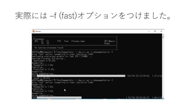 3D Slicer　講座　番外編③TotalSegmentatorによるCTの自動セグメンテーション смотреть онлайн