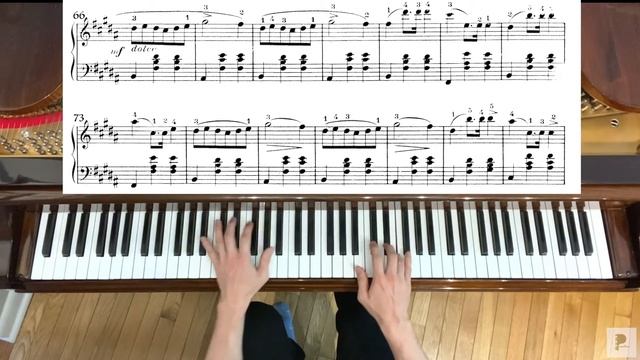 CHOPIN WALTZ OP 69 NO 2 IN B MINOR With Sheetmusic