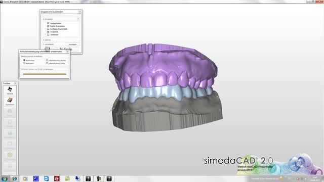 simedaCAD (exoCAD) Bitesplint Virtual Articulator смотреть онлайн