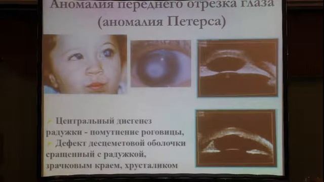 Ультразвуковые методы диагностики в детской офтальмологии смотреть онлайн