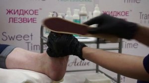 Процедура педикюра с применением геля кератолитика 'Жидкое лезвие' от DOMIX