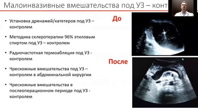 Круглый стол "Новые форматы обучения на примере авторской школы УЗИ профессора Борсукова А.В.» смотреть онлайн
