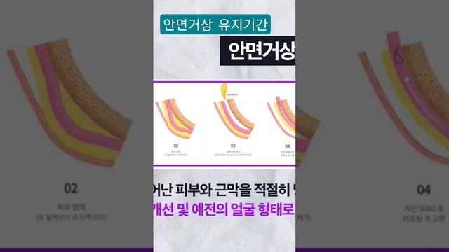 #안면거상술 솔직 유지기한
