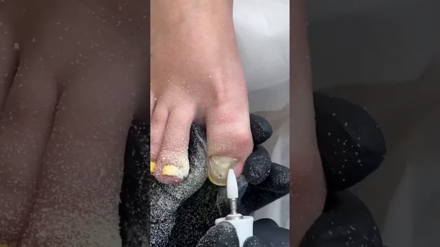 Нельзя наращивать ногти на ногах❗️❗️❗️ смотреть онлайн