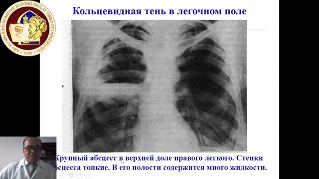 Рентгенограмма легких. смотреть онлайн