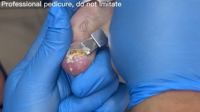 Pedicure Tutorial：Extra long toenails!【Pedicure Master Lin Jun】 смотреть онлайн