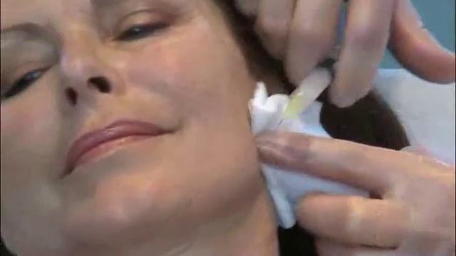 Viscoderm 1,6% 30 Gneedle Dr Salti