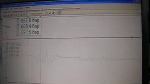 Проверка датчика давления в рейле на SsangYong Kyron