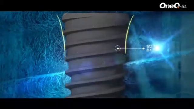 Зубные импланты ONE-Q SLA Dentis/ Южная Корея смотреть онлайн
