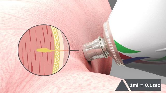 FreVAX, intramuscular needle free device for pigs. Mode of action. смотреть онлайн