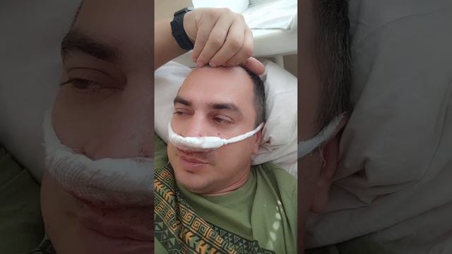 Септопластика, исправление носовой перегородки ч.2 смотреть онлайн