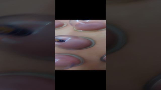 сухая хиджама - вакуумный массаж смотреть онлайн