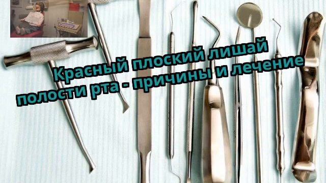 Красный плоский лишай полости рта - причины и лечение смотреть онлайн