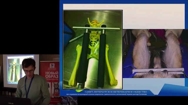 Диагностика дисплазии ТБС.