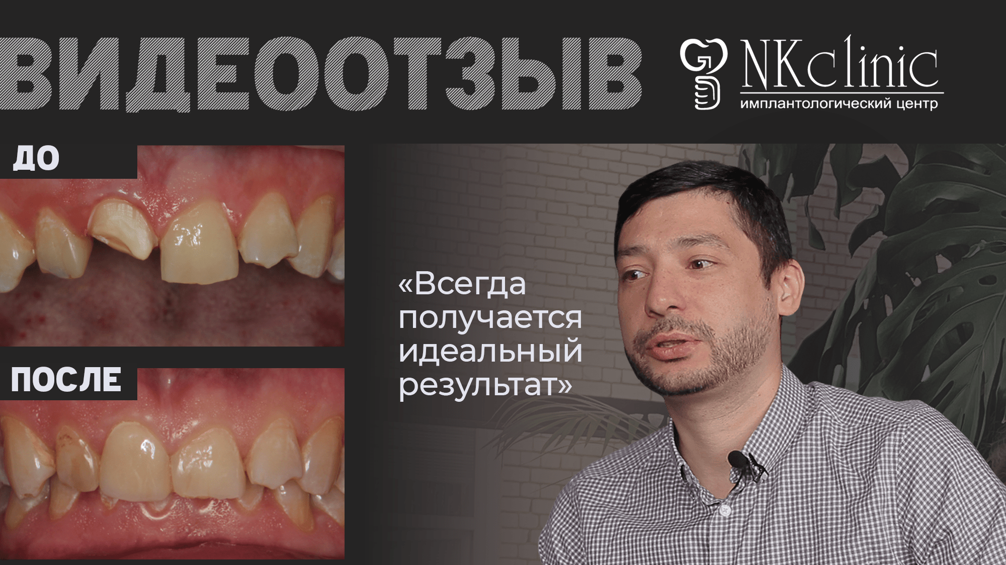 NKclinic - отзывы пациентов. Имплантация и протезирование для зубного техника.