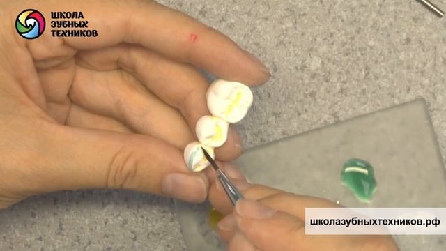 Облицовка диоксида циркония Полноанатомические конструкции 1 смотреть онлайн