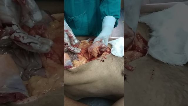 Live postmortem examination from GMC mortuary смотреть онлайн