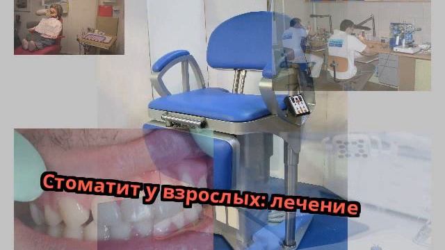 Стоматит у взрослых: лечение смотреть онлайн