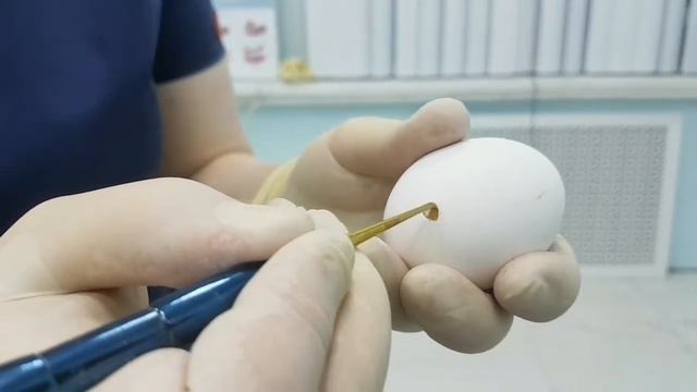 Синуслифтинг на примере яица 1 смотреть онлайн