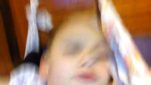 Компресионный перелом смотреть онлайн