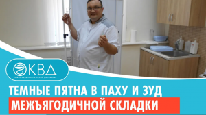 ☹ Темные пятна в паху и зуд межъягодичной складки. Клинический случай №463