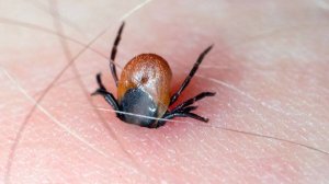 Врач рассказала, как отличить укус зараженного боррелиозом клеща