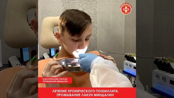 Лечение хронического тонзиллита. Промывание лакун миндалин