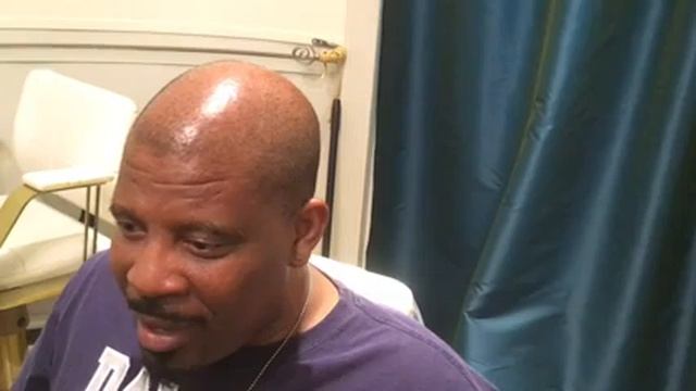 Hairline Correction For Mr. N |The Hair Simulation Company