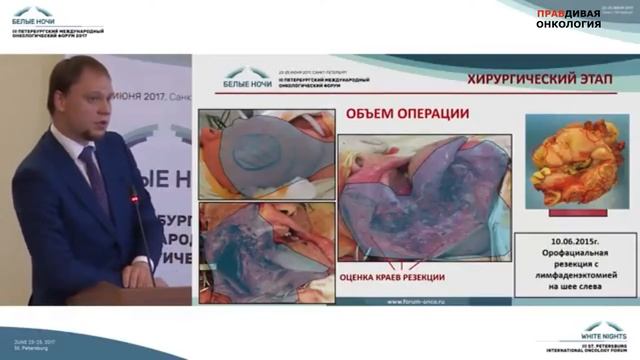 Рак полости рта и глотки смотреть онлайн