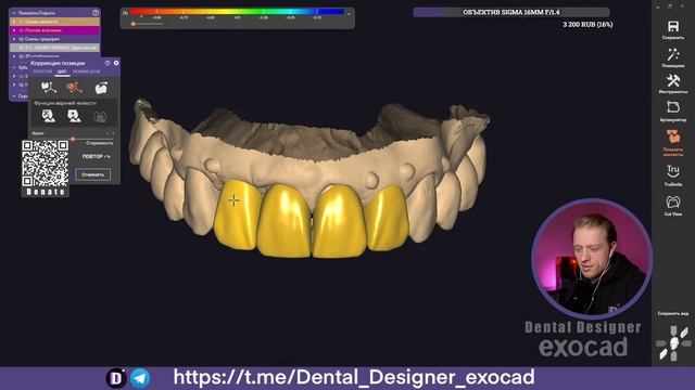 Exocad Stream / New ARTiPoly / Buganov CHARISMA (NewTooth Library)