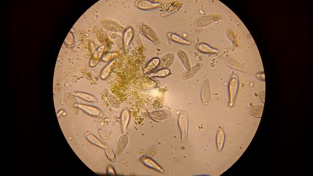 Жизнь под микроскопом: инфузории-туфельки бьются за еду (Life under microscope: Paramecium) смотреть онлайн
