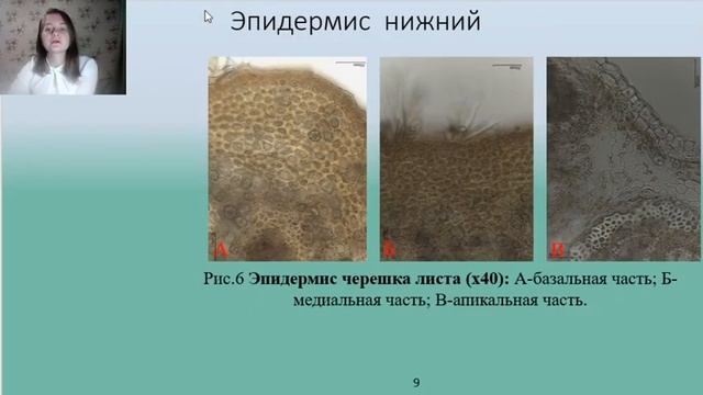 ИССЛЕДОВАНИЕ ПЕТИОЛЯРНОЙ АНАТОМИИ ЛИСТЬЕВ ДУБА КРУПНОПЛОДНОГО смотреть онлайн