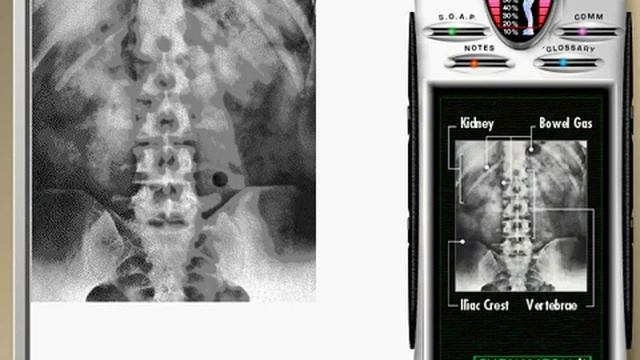 Emergency Room: Disaster Strikes - Case 296 - Swallowed object (Eduardo Pena, Coin in GI tract) смотреть онлайн