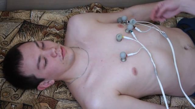 Техника регистрации ЭКГ до и после нагрузки смотреть онлайн