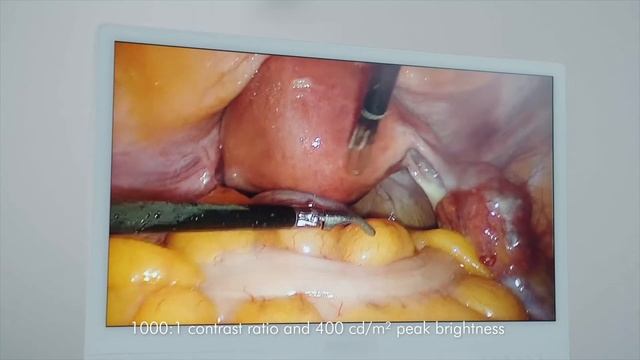 E240AG - 24" FHD Surgical Monitor (English) смотреть онлайн