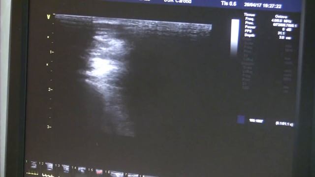 Носенко Е.М. Исследование сосудов верхних конечностей! смотреть онлайн