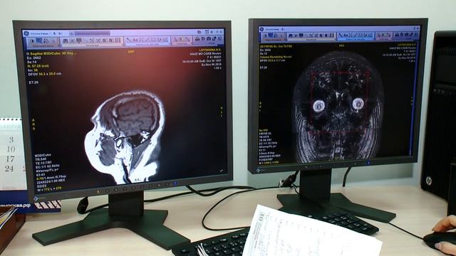 МРТ 06.11.2018 смотреть онлайн