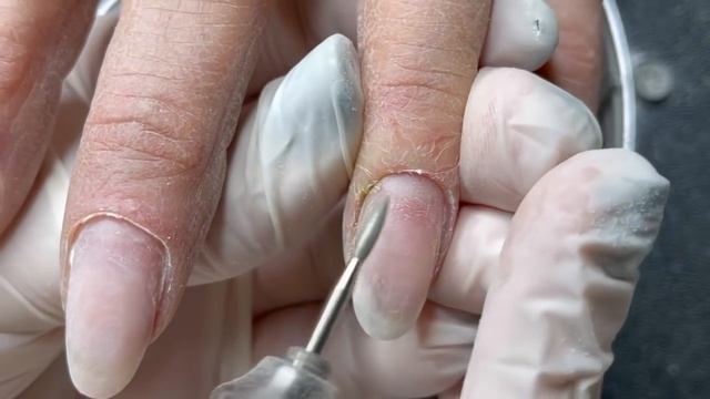 «ПОЛНЫЙ ФАРШ»?ОНИХОЛИЗИС+КЛЮЮЩИЕ НОГТИ +СЛОЖНАЯ КУТИКУЛА? смотреть онлайн