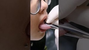 Tindik Lidah itu Sakit Gak Sih? - Tongue Piercing