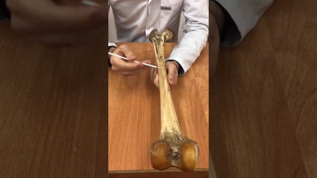 Нормальная анатомия бедренной кости. смотреть онлайн