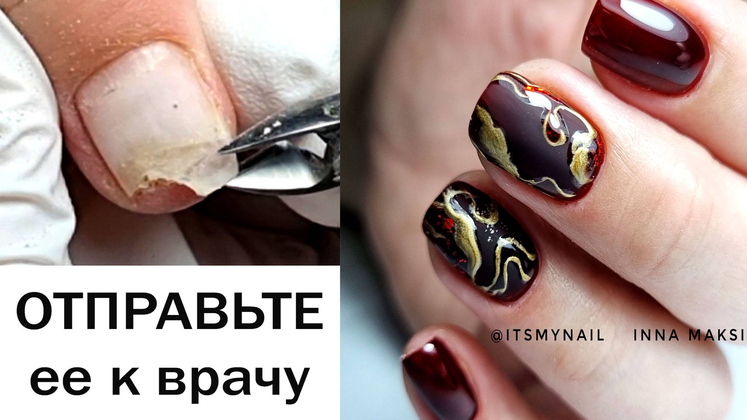 бесячие ТРАВМЫ